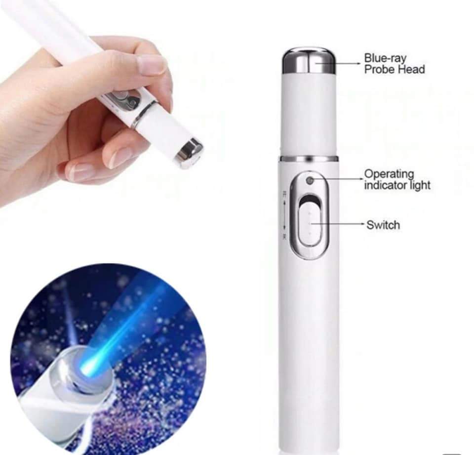 LaserPen™ - Caneta Laser Tratamento de Varizes e Acne